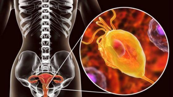 Cyclic-Vulvovaginitis-4.jpg